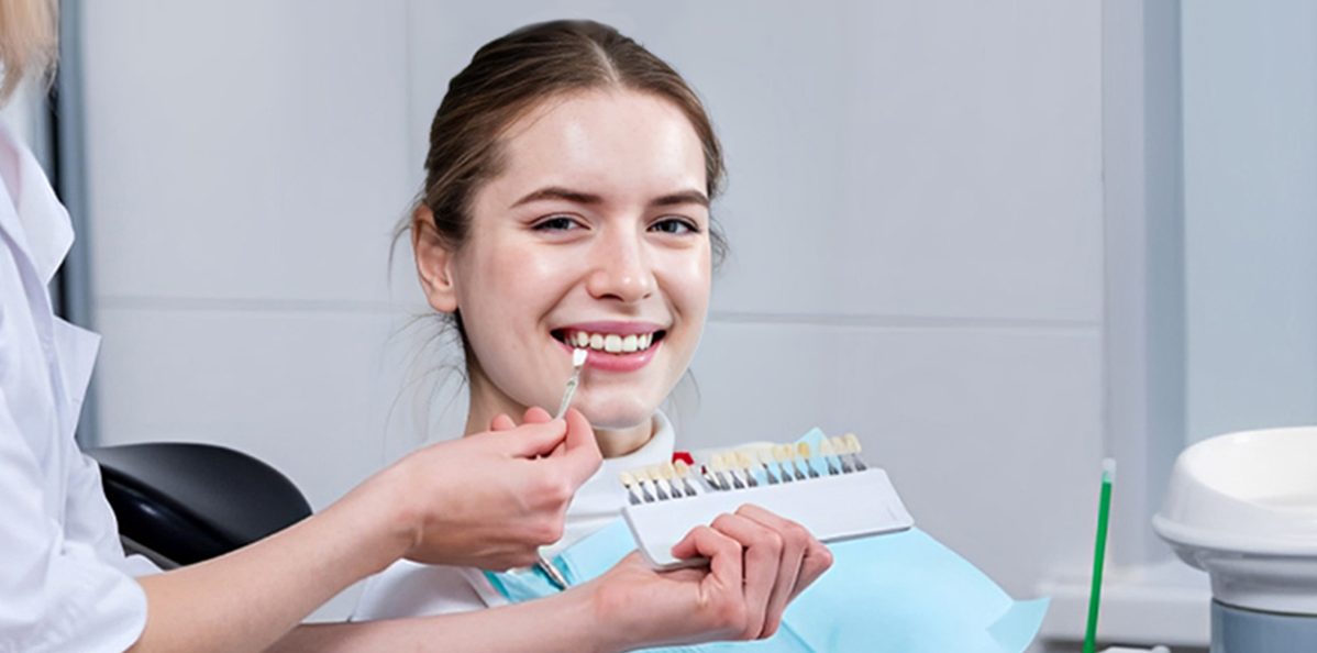 What Should You Expect During a Veneer Consultaion