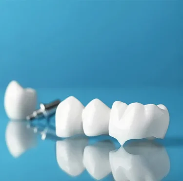 What Should You Avoid After Getting a Dental Crown